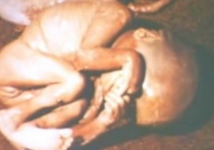 Abtreibung 4.jpg
